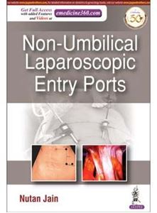 Picture of Non-Umbilical Laparoscopic Entry Ports