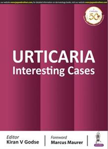 Picture of URTICARIA: Interesting Cases 