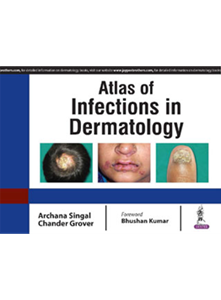 Picture of Atlas of Infections in Dermatology